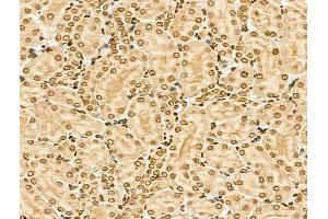 anti-Nuclear Receptor Coactivator 6 (NCOA6) (Internal Region) antibody