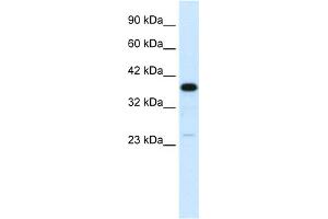 WB Suggested Anti-C4BPB Antibody Titration:  0. (C4BPB Antikörper  (N-Term))