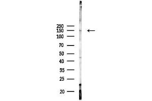 anti-Multimerin 1 (MMRN1) antibody