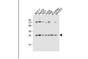 All lanes : Anti-Prohibitin (PHB1) Antibody (N-term) at 1:2000 dilution Lane 1: MCF-7 whole cell lysate Lane 2: HepG2 whole cell lysate Lane 3: A431 whole cell lysate Lane 4: Jurkat whole cell lysate Lane 5: Hela whole cell lysate Lane 6: Mouse kidney tissue lysate Lane 7: NIH/3T3 whole cell lysate Lysates/proteins at 20 μg per lane.
