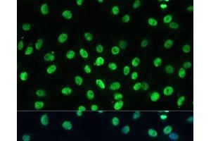 Immunofluorescence analysis of C6 cells using TRIM28 Polyclonal Antibody at dilution of 1:100 (40x lens). (KAP1 Antikörper)