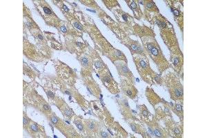 Immunohistochemistry of paraffin-embedded Human liver using CAD Polyclonal Antibody at dilution of 1:100 (40x lens). (CAD Antikörper)