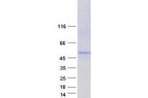 Western Blotting (WB) image for Cystinosis, Nephropathic (CTNS) (Transcript Variant 2) protein (Myc-DYKDDDDK Tag) (ABIN2712807)