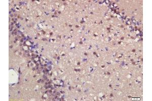 Formalin-fixed and paraffin embedded rat brain labeled with Rabbit Anti-MASH1 Polyclonal Antibody, Unconjugated  at 1:200 followed by conjugation to the secondary antibody and DAB staining (ASCL1 Antikörper  (AA 151-236))