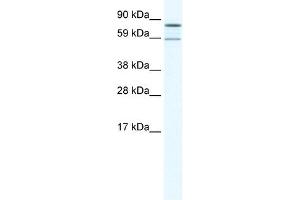 Western Blot showing PARN antibody used at a concentration of 1-2 ug/ml to detect its target protein. (PARN Antikörper  (N-Term))