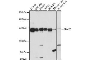 Western blot analysis of extracts of various cell lines, using RBM25 antibody (ABIN7270082) at 1:1000 dilution. (RBM25 Antikörper  (AA 614-843))