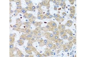Immunohistochemistry of paraffin-embedded Human liver using NMU Polyclonal Antibody at dilution of 1:100 (40x lens). (Neuromedin U Antikörper)