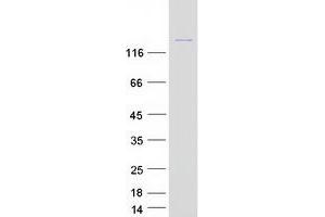 Western Blotting (WB) image for rho-Associated, Coiled-Coil Containing Protein Kinase 2 (ROCK2) protein (Myc-DYKDDDDK Tag) (ABIN2731061)