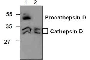 Western blot analysis of Cathepsin D in 3T3 cell lysate (Lane 1) and in Rat kidney tissue lysate (Lane 2). (Cathepsin D Antikörper)