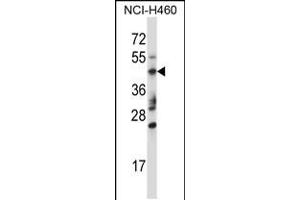 Western blot analysis in NCI-H460 cell line lysates (35ug/lane). (TRIM15 Antikörper  (AA 247-276))
