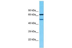 Western Blotting (WB) image for anti-Transmembrane Protein 232 (TMEM232) (N-Term) antibody (ABIN2791955) (TMEM232 Antikörper  (N-Term))