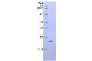 SDS-PAGE analysis of Mouse Nucleophosmin Protein. (NPM1 Protein)
