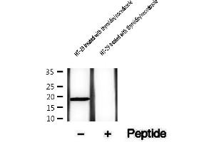 Western blot analysis of extracts of HT-29 cells treated with thymidin/nocodozole, using Phospho-Survivin (Thr34) Antibody . (Survivin Antikörper  (pThr34))