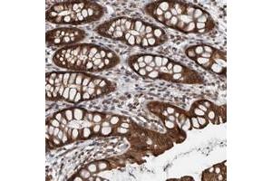 Immunohistochemical staining of human rectum with ENY2 polyclonal antibody  shows strong positivity in glandular cells.