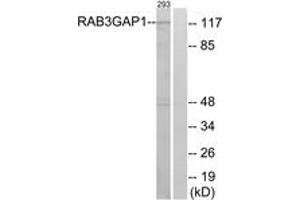 Western Blotting (WB) image for anti-RAB3 GTPase Activating Protein Subunit 1 (Catalytic) (RAB3GAP1) (AA 538-587) antibody (ABIN2879203) (RAB3GAP1 Antikörper  (AA 538-587))