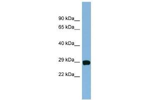 CHCHD3 antibody used at 1 ug/ml to detect target protein. (CHCHD3 Antikörper  (N-Term))