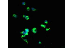 Immunofluorescent analysis of 293T cells using ABIN7170195 at dilution of 1:100 and Alexa Fluor 488-congugated AffiniPure Goat Anti-Rabbit IgG(H+L) (SLC25A4 Antikörper  (AA 40-102))