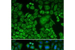 Immunofluorescence analysis of HeLa cells using ACTR3 Polyclonal Antibody (ACTR3 Antikörper)