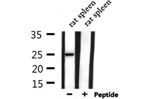 Western blot analysis of extracts from rat spleen, using CACNG1 Antibody. (CACNG1 Antikörper  (Internal Region))