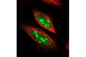 Immunofluorescent staining of human cell line U-2 OS with SDAD1 polyclonal antibody  at 1-4 ug/mL dilution shows positivity in nucleus and nucleoli.