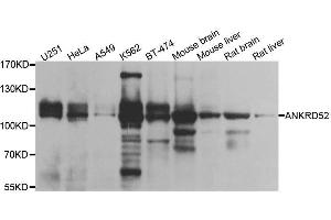 Western blot analysis of extracts of various cell lines, using ANKRD52 antibody. (ANKRD52 Antikörper  (AA 450-660))