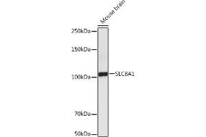 Western blot analysis of extracts of Mouse brain , using SLC8 antibody (ABIN6132664, ABIN6148050, ABIN6148052 and ABIN6221228) at 1:5000 dilution.