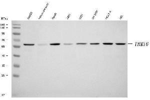 Western blot analysis of TRMT6 using anti-TRMT6 antibody (ABIN7602138).