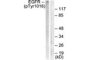 Western blot analysis of extracts from HuvEc cells treated with Serum 20% 30', using EGFR (Phospho-Tyr1016) Antibody. (EGFR Antikörper  (pTyr1016))