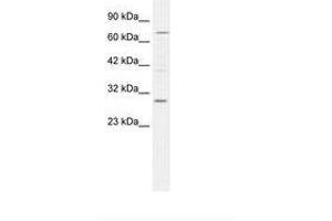 Image no. 2 for anti-Kv Channel Interacting Protein 1 (KCNIP1) (N-Term) antibody (ABIN202072) (KCNIP1 Antikörper  (N-Term))