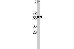 Western blot analysis of CNOT4 polyclonal antibody  in CEM cell line lysates (35 ug/lane).