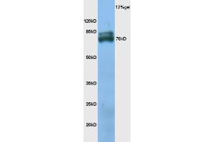 Mouse skeletal muscle lysate probed with Anti TXLNB Polyclonal Antibody, Unconjugated (ABIN1386717) at 1:200 overnight at 4 °C. (Taxilin beta Antikörper  (AA 331-430))