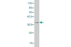 Western Blot detection against Immunogen (34. (HAND2 Antikörper  (AA 135-216))