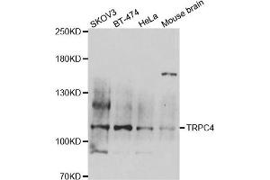 Western blot analysis of extracts of various cell lines, using TRPC4 antibody. (TRPC4 Antikörper)