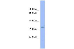 WB Suggested Anti-C20orf116 Antibody Titration:  0. (DDRGK1 Antikörper  (Middle Region))