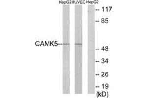 Western blot analysis of extracts from HepG2/HuvEc cells, using CAMK5 Antibody.