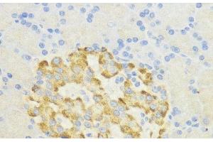 Immunohistochemistry of paraffin-embedded Rat pancreatic islet using SURF4 Polyclonal Antibody at dilution of 1:200 (40x lens). (Surfeit 4 Antikörper)