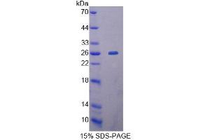 SDS-PAGE analysis of Human MTERF Protein.