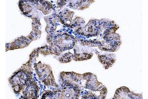 IHC analysis of Tspan-8/Tspan8 using anti-Tspan-8/Tspan8 antibody (ABIN7599681). (Tspan-8 Antikörper  (AA 108-203))