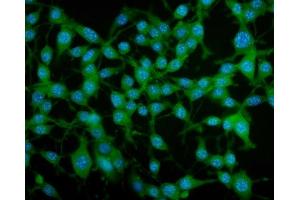 IF analysis of PAR4/Pawr using anti-PAR4/Pawr antibody (ABIN7599938). (PAWR Antikörper  (AA 13-333))