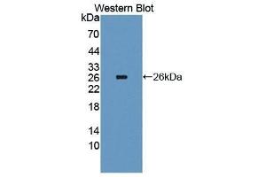 Western Blotting (WB) image for anti-Interleukin 4 Receptor (IL4R) antibody (Biotin) (ABIN1175405) (IL4 Receptor Antikörper  (Biotin))