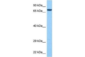 Host:  Rabbit  Target Name:  PTPRN  Sample Tissue:  Human Liver Tumor  Antibody Dilution:  1ug/ml (PTPRN Antikörper  (Middle Region))