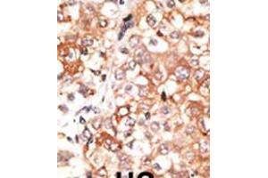 Immunohistochemistry (IHC) image for anti-Gap Junction Protein, gamma 1, 45kDa (GJC1) (AA 89-120), (N-Term) antibody (ABIN5534076)