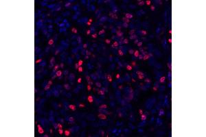Immunofluorescence (IF) image for anti-Antigen Identified By Monoclonal Antibody Ki-67 (MKI67) (AA 1200-1250) antibody (ABIN7449552) (Rekombinanter Ki-67 Antikörper  (AA 1200-1250))