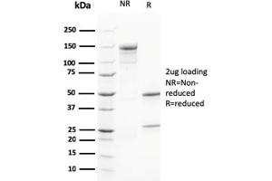 SDS-PAGE Analysis Purified Calretinin Mouse Monoclonal Antibody (CALB2/2602).