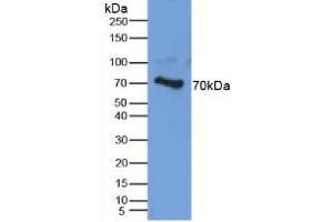 Detection of AGC in Human Cartilage Tissue using Polyclonal Antibody to Aggrecan (AGC) (Aggrecan Antikörper  (AA 34-147))