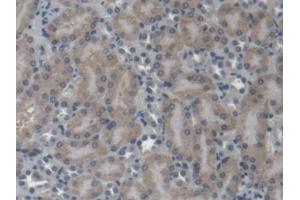 DAB staining on IHC-P; Samples: Mouse Kidney Tissue (EPRS Antikörper  (AA 1007-1512))