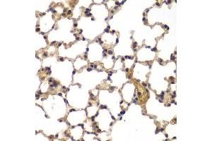 Immunohistochemistry of paraffin-embedded mouse lung using ASPSCR1 antibody at dilution of 1:100 (x400 lens). (ASPSCR1 Antikörper)