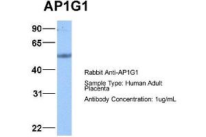 Host: Rabbit Target Name: AP1G1 Sample Type: Human Adult Placenta Antibody Dilution: 1. (gamma 1 Adaptin Antikörper  (C-Term))