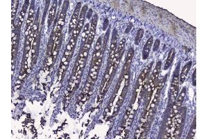 IHC analysis of Cytokeratin 19 using anti-Cytokeratin 19 antibody (ABIN3043288).
