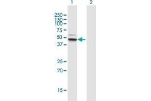 Western Blot analysis of ALDH3B1 expression in transfected 293T cell line by ALDH3B1 MaxPab polyclonal antibody. (ALDH3B1 Antikörper  (AA 1-431))